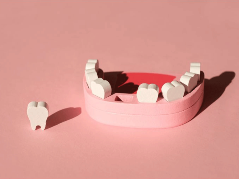 wooden tooth model with a a tooth knocked out